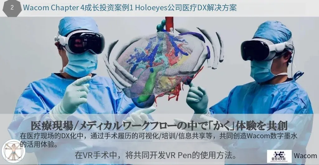 Wacom 整合 Holoeyes 以增强医学影像业务，探索 VR 在医疗领域的新应用场景