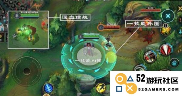 英雄联盟手游诺手该怎么玩